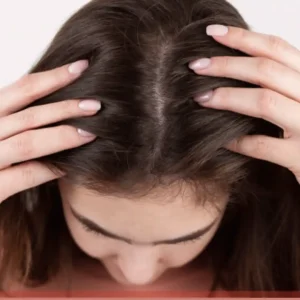 علاج جلدة الشعر